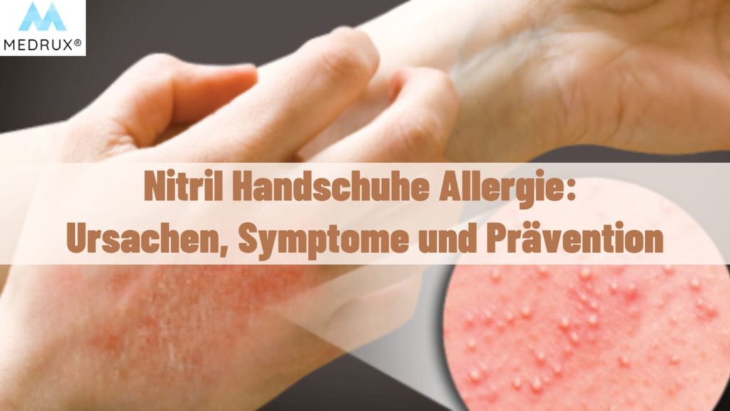 Nitril Handschuhe Allergie