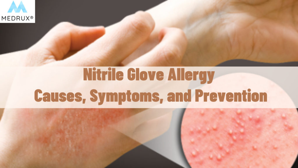 An Overview of Latex Allergy Gloves